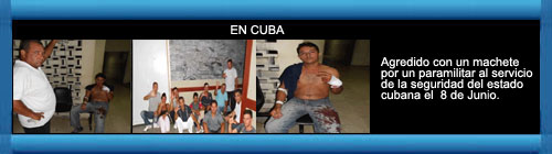 CUBA FOTORREPORTAJE: Werlando Leyva Batista, Miembro del Movimiento Cristiano Liberaci�n, en la zona campesina La Yuraguana, cercano al poblado de San Andr�s, provincia Holgu�n, fue agredido con un machete por un paramilitar al servicio de la seguridad. web/folder.asp?folderID=136 
